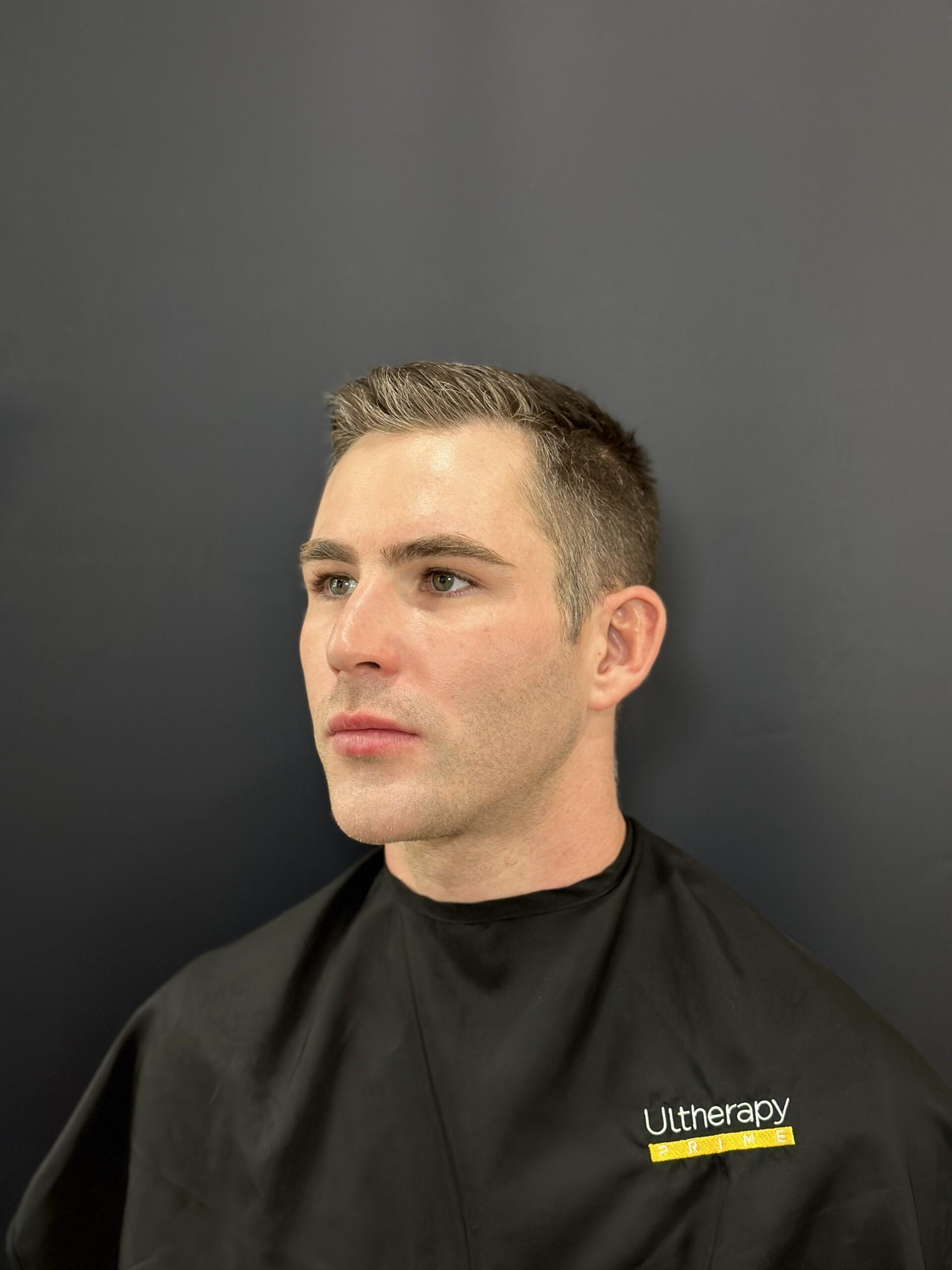 Ultherapy Prime Treatments | Edinburgh | Botox Injectables